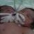 تولد نوزاد دو سر در بیمارستان بزرگ دزفول + عکس