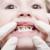 ۴ عاملی که سبب پوسیدگی دندان می‌شود