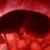تالاسمی ماژور در فهرست سقط درمانی قانونی قرار دارد