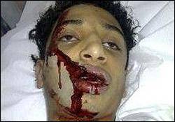 واکنش شدیداللحن مهمانپرست به شهادت نوجوان 14 ساله بحرینی