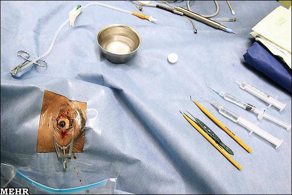 عکس/ عمل جراحی چشم
