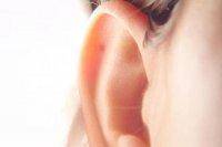 لیزر مؤثر در کاهش وزوز گوش 