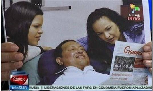 اولین تصویر چاوز پس از عمل جراحی