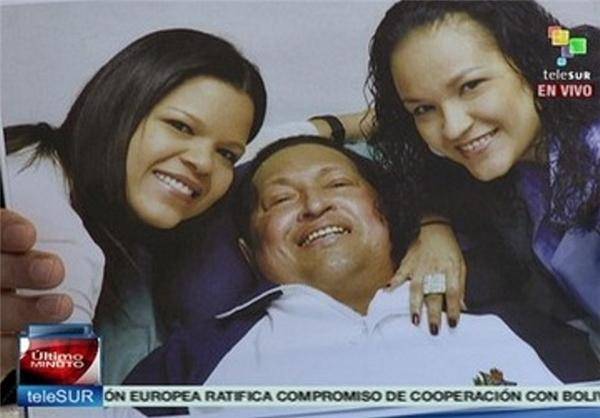اولین تصویر «چاوز» پس از عمل جراحی سرطان