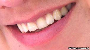 پژوهشگران از سلول‌های لثه دندان رویاندند
