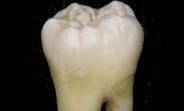 جايگزينی دندان خراب با دندان بيولوژيكي
