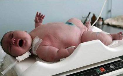 تولد سنگین وزن ترین نوزاد جهان/ عکس