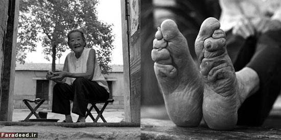 بازماندگان زنان پا کوچک در چین/تصاویر