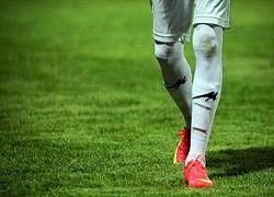 اتفاق ویژه: حضور دو بازیکن مبتلا به هپاتیت در لیگ برتر تایید شد