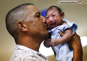 کودک میکروسفالی در آغوش پدر+عکس