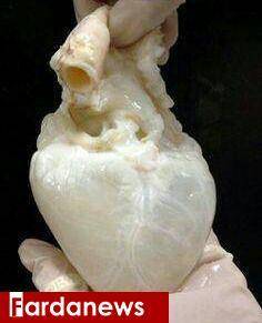 عکس: قلب انسان پس از تخلیه کامل خون