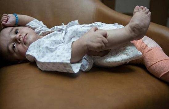 نوزادی بسیار عجیب الخلقه به دنیا آمد!+ تصویر