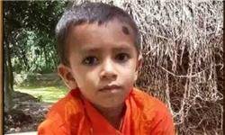 دست عجیب پسر 5 ساله بنگلادشی+تصاویر