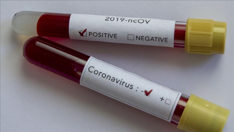 لیست بیمارستان‌های پذیرش کننده بیماران کروناویروس اعلام شد