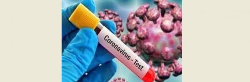 تولید کیت آزمایش کروناویروس در دانشگاه شیراز