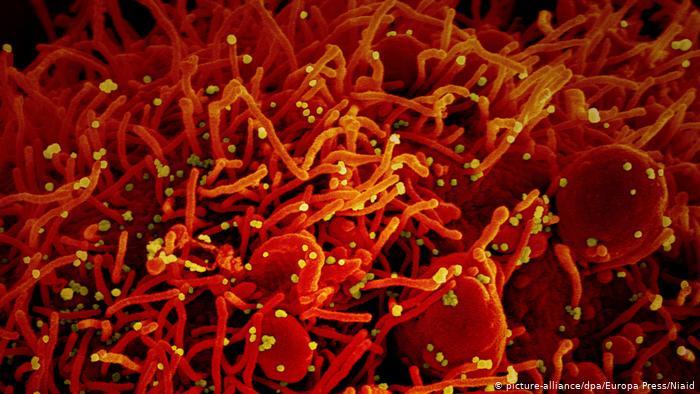 محققان آلمانی از کشف بازدارنده ویروس کرونا در سلول می‌گویند