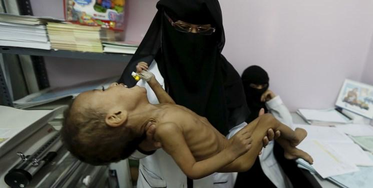 هر ۵ دقیقه یک کودک یمنی می‌میرد