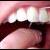 استفاده از نخ دندان از مسواك واجب‌تر است