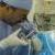  موفقیت پزشکان ایرانی در روش جدید جراحی کلیه