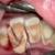 اثر 10سال مسواک نکردن دندان‌ها/عکس