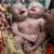 تولد نوزاد با دوسر در بنگلادش + تصاویر