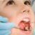 پرداختی 90 درصد هزینه‌های دندانپزشکی از جیب مردم است