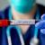ثبت نخستین مرگ بیمار مبتلا به ویروس کرونا در استرالیا