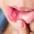 علل بروز آفت دهان و روش‌های درمان آن