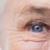 مشکلات جدی چشمی در این افراد شایع است