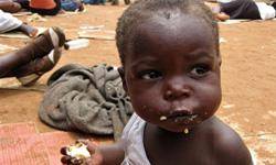 يك ميليارد نفر در جهان دچار سوء تغذيه شده اند