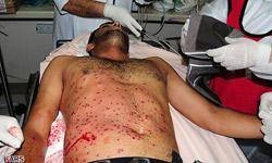 آل خليفه حملات عليه مردم بحرين را تشديد كرد