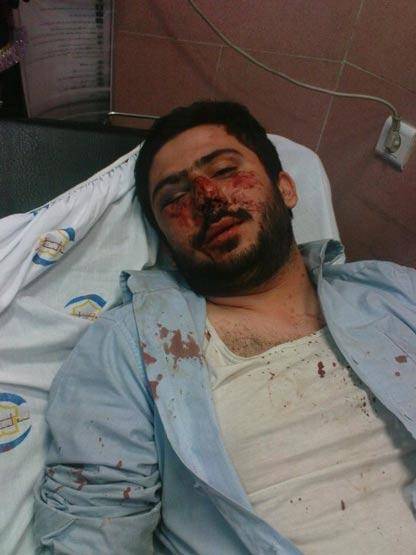 باز هم حمله به بسیجی آمر به معروف! +عکس