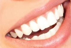 سفید کردن دندان بدون نیاز به داندان پزشک