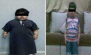 چاق ترين کودک دنيا لاغر شد/عکس