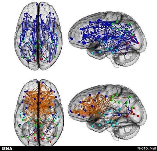 تفاوت جالب مغز مردان و زنان (+عکس)