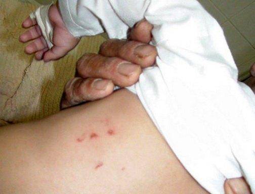 شکنجه کودک در دخمه معتادان (تصویر)
