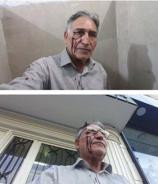 محمد نوری زاد مورد ضرب و شتم مجدد نیروهای امنیتی قرارگرفت و بازداشت شد + عکس