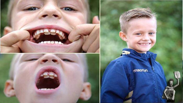 کودکی با ۳۰۰ دندان در فیلیپین! +عکس