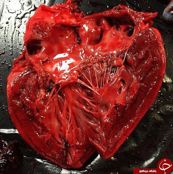 قلب بعد از مردن چه شکلی است؟ +تصاویر ۱۸+