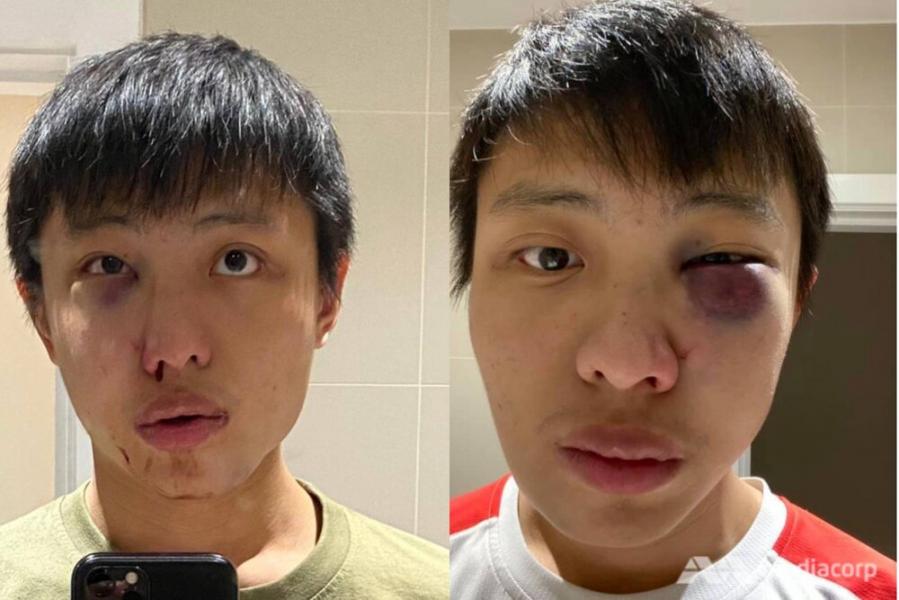 حمله به دانشجوی سنگاپوری در لندن بخاطر ویروس کرونا/ عکس