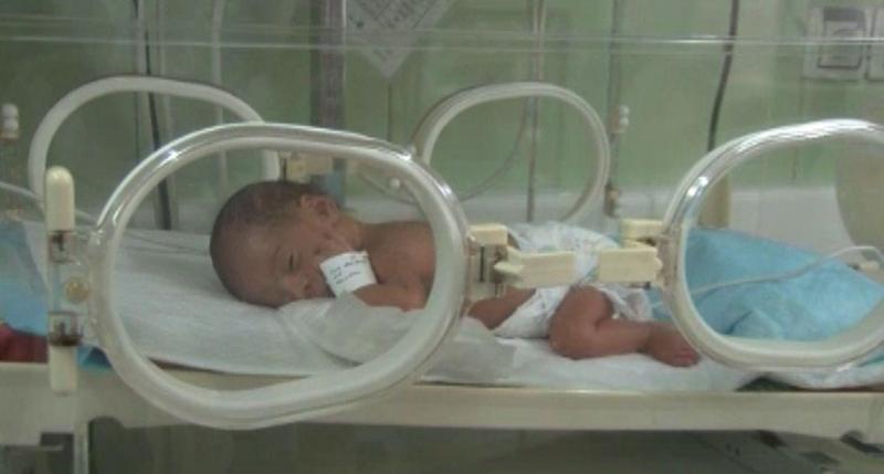 تولد نوزاد از مادر کرونایی بعد از ۲۰ سال نازایی