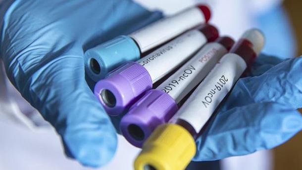 تعداد مبتلایان به کرونا ویروس در جهرم به ۷۲ نفر رسید