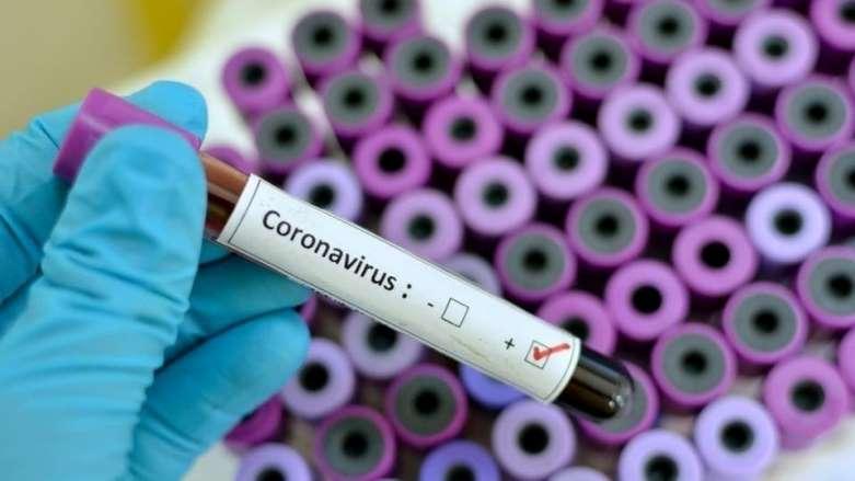 از شایعه تا واقعیت واردات داروی ضد کرونای favipiravir برای مسئولان