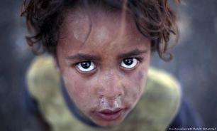 فاجعه بشری در یمن؛ کشتار کودکان تکمیل کننده پازل جنایات عربستان