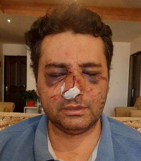 ضرب و شتم شدید متخصص بیهوشی در پیرانشهر - Gooya News