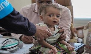 فاجعه در یمن و قطع حمایت‌ نهادهای بشردوستانه سازمان ملل
