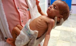 قحطی و گرسنگی کودکان یمنی؛ میراث شوم جنگ افروزی عربستان