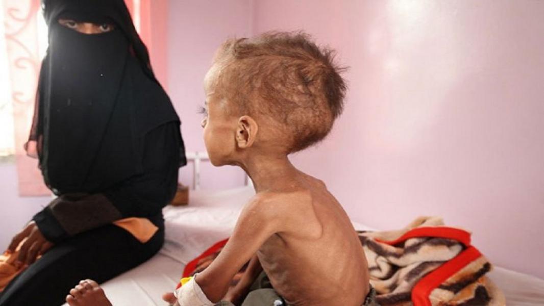 ایندیپندنت: ۲۰۲۰ بدترین سال غذایی برای مردم یمن است