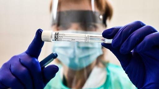 دستگاهی برای تشخیص زودهنگام کرونا با اندازه‌گیری میزان اکسیژن‌های فعال طراحی شد