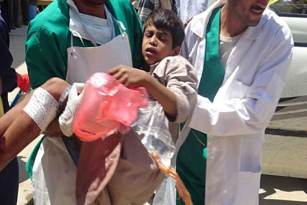 حملات توپخانه‌ای سعودی‌ها به «الحدیده» یمن/ یک شهید و ۱۱ زخمی